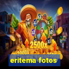 eritema fotos